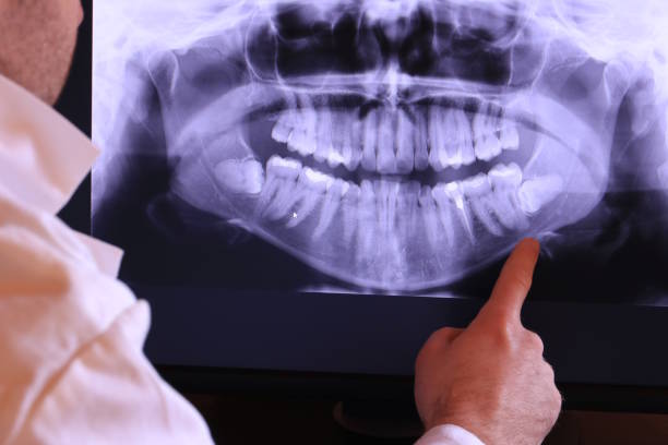 Best Mobile Emergency Dentist in Story City, IA
