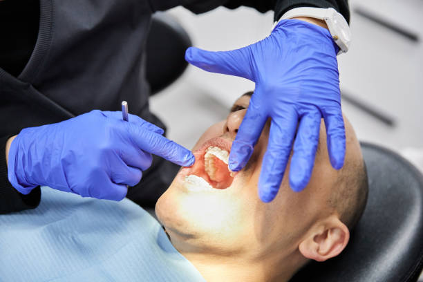 Best Emergency Dentist for Knocked-Out Tooth in Story City, IA